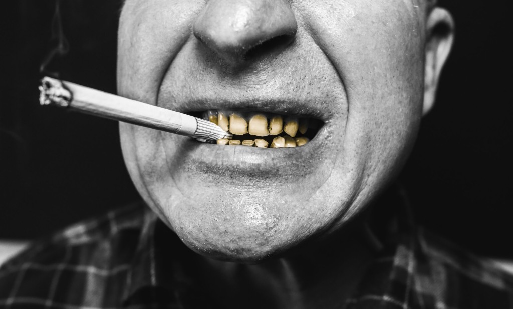 タバコは歯周病に関係ありますか？