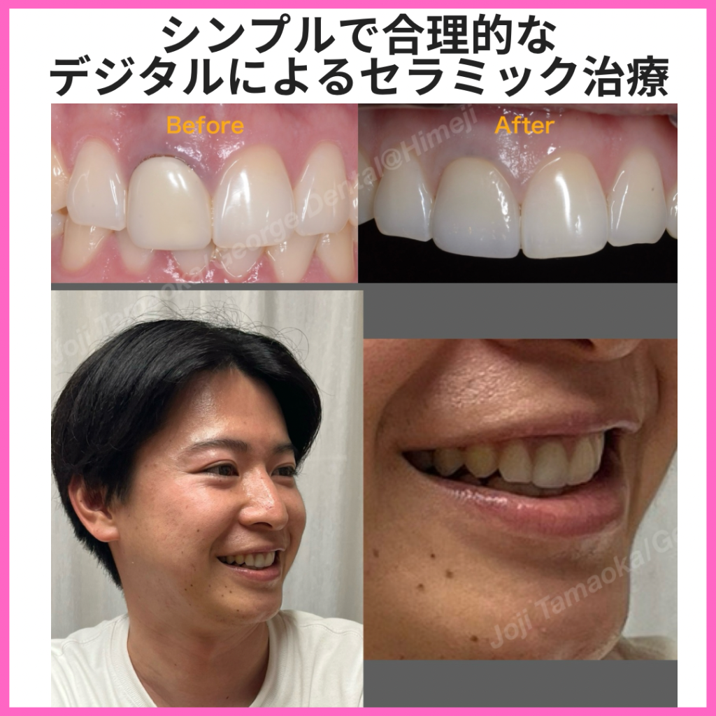 シンプルで合理的なデジタルによるセラミック治療